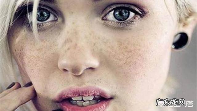 为何怀孕之后满脸长斑,产后如何才能快速祛除面部黄褐斑?