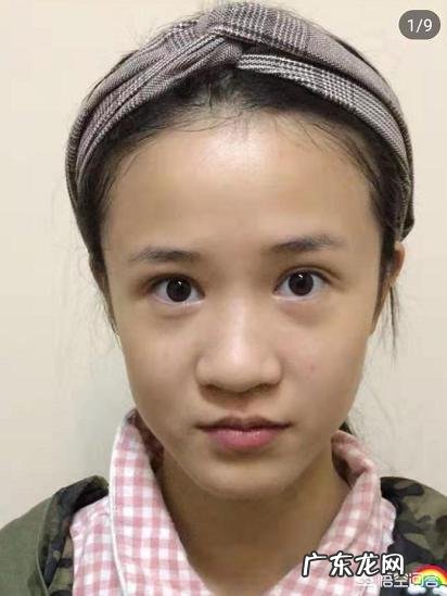 鼻子又大又塌,我该怎么办?