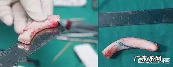 鼻子又大又塌,我该怎么办?