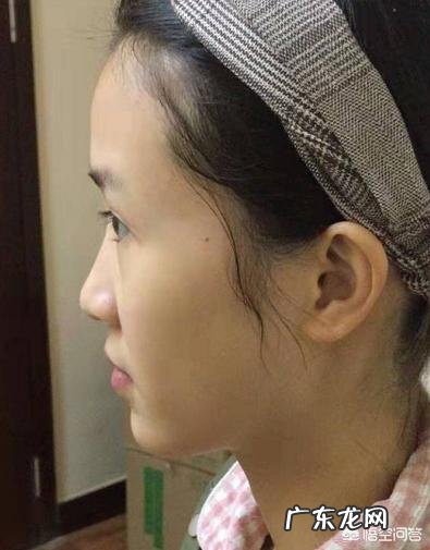 鼻子又大又塌,我该怎么办?