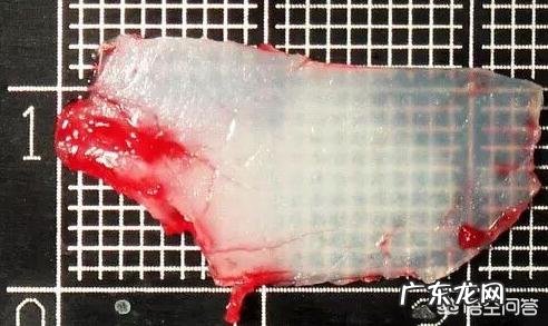 鼻子又大又塌,我该怎么办?