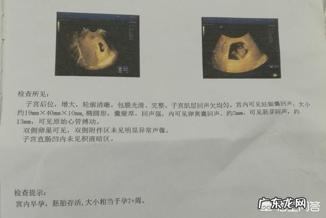 出现什么症状表示没有怀孕?