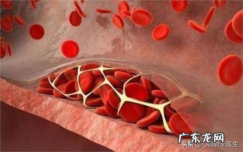 鱼油降血脂靠谱吗?