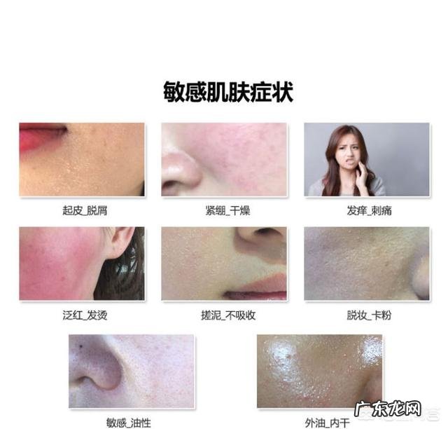 我脸上的红血丝很重,怎么祛除?