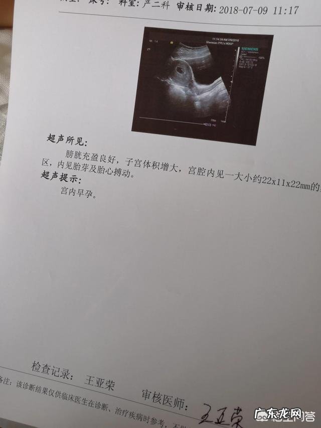 第一次产检需要检查什么?