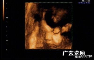 几个月的时候做四维和唐氏筛查?