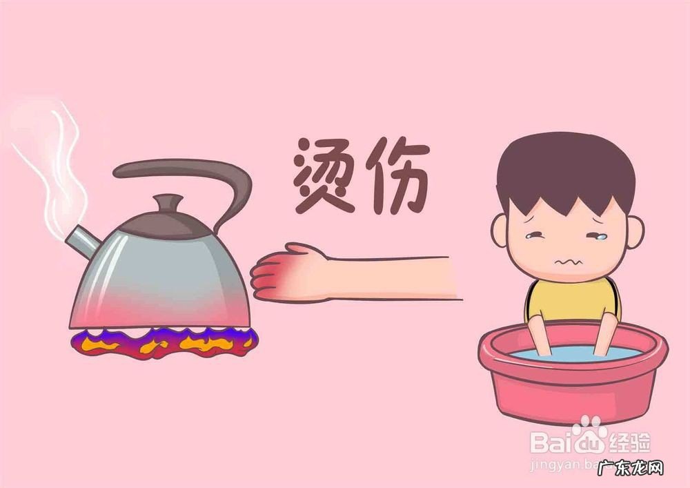 开水烫伤怎么办好得快