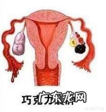 什么样的卵巢囊肿必须要做手术？