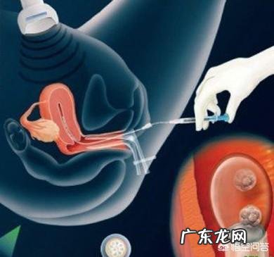 试管婴儿移植后如何让胚胎快速着床?