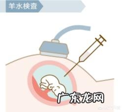 无创DNA什么情况下需要做?