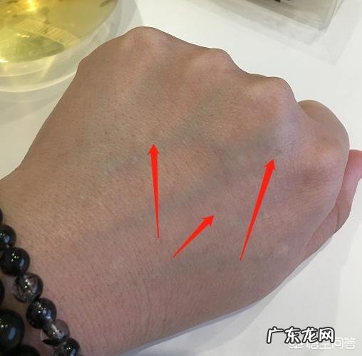 产生黄褐斑的原因有哪些?黄褐斑能自己消退吗?