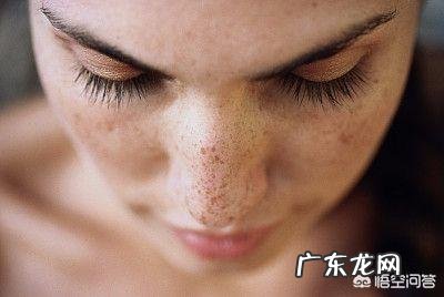 产生黄褐斑的原因有哪些?黄褐斑能自己消退吗?