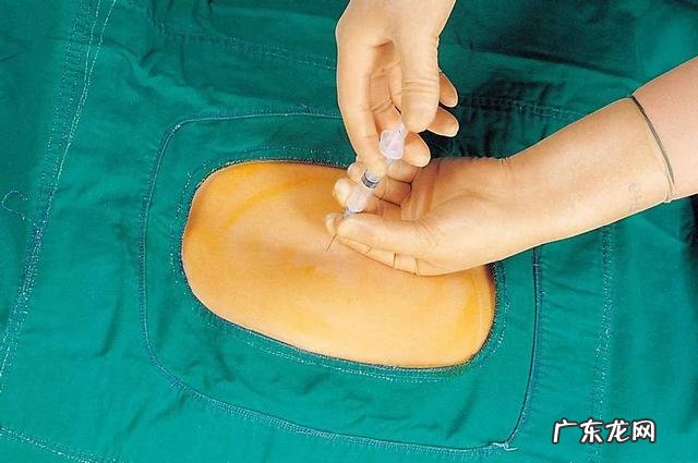 无痛分娩，是否对产程有影响？