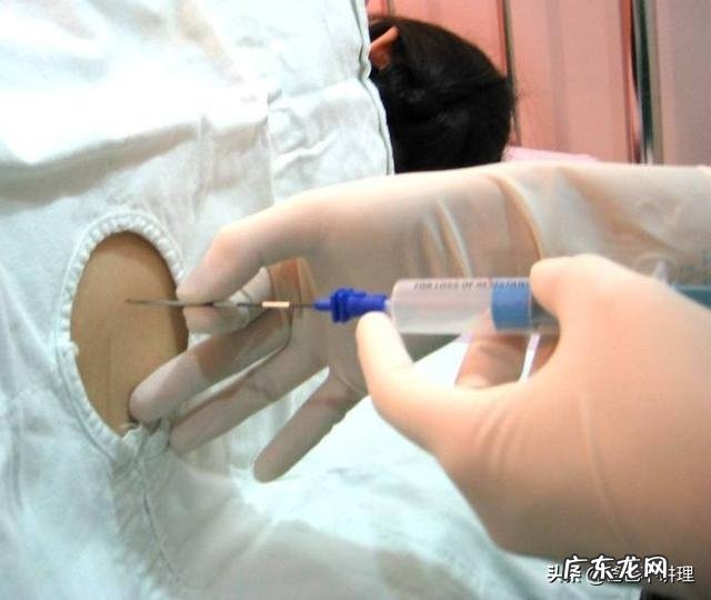 扛不住产痛时，除了“剖”还有更好的选择吗？