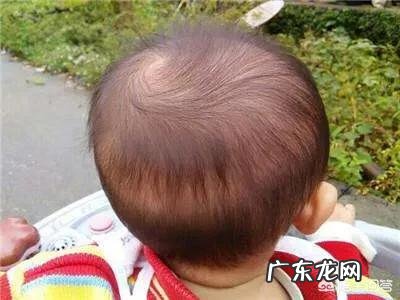 八个月宝宝的缺钙表现是怎样的呢?