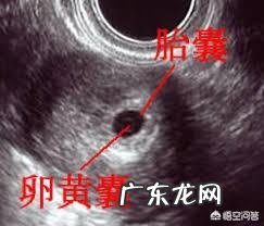 怀孕60天,孕囊发育大小是怎样的呢?