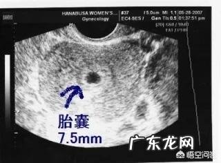怀孕60天,孕囊发育大小是怎样的呢?