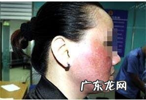 白醋泡白术,能祛斑吗?