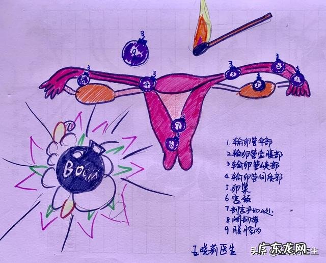 宫外孕有那些症状?