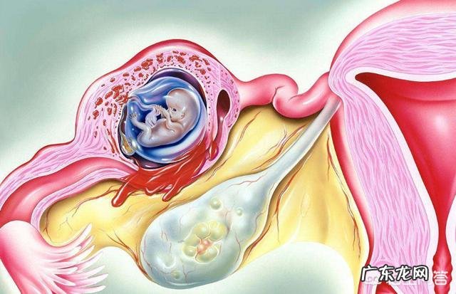 宫外孕有那些症状?