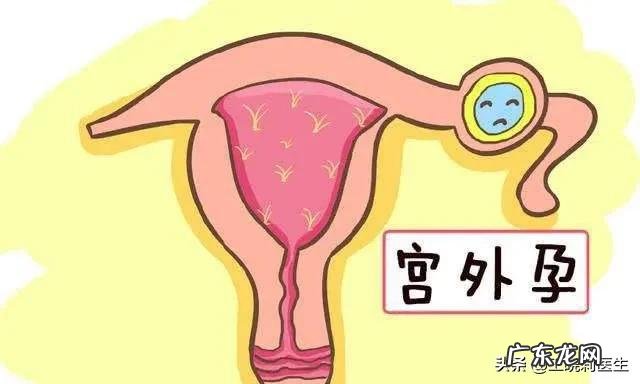 宫外孕有那些症状?