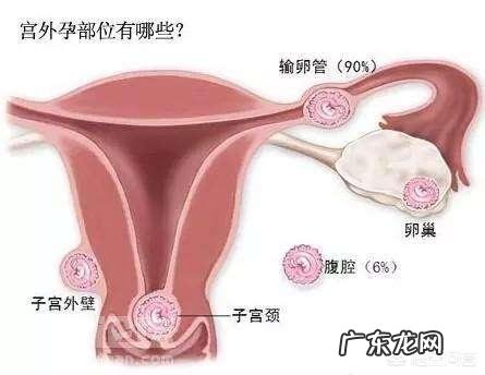 宫外孕有那些症状?