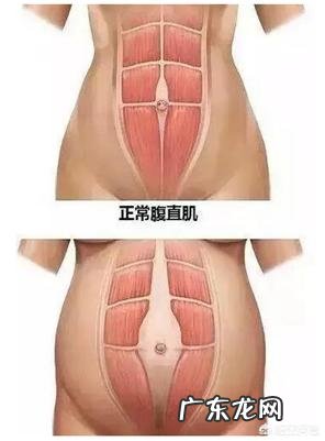 产后腰痛怎么缓解?