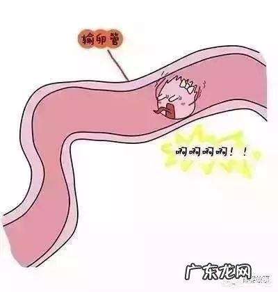 “双胞胎”胎儿是怎么形成的?