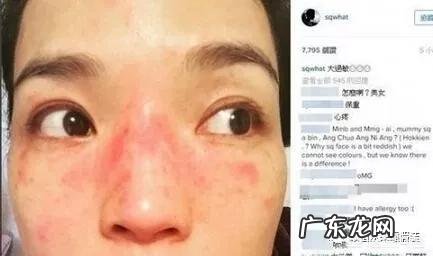 女生如何自己在家脱毛?