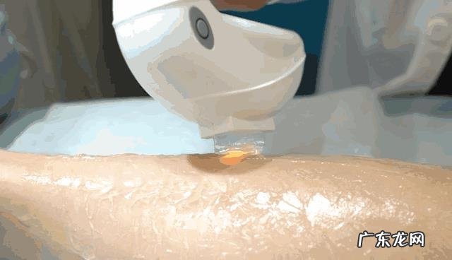 女生如何自己在家脱毛?