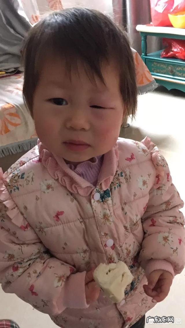 宝宝被蚊子咬了,哪些方法可以缓解呢?