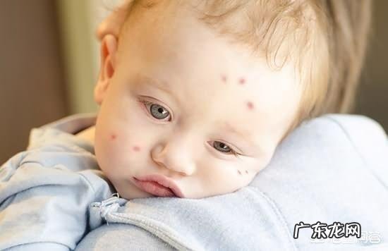 宝宝被蚊子咬了,哪些方法可以缓解呢?
