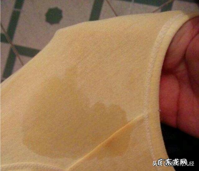 二胎临产前有什么征兆?