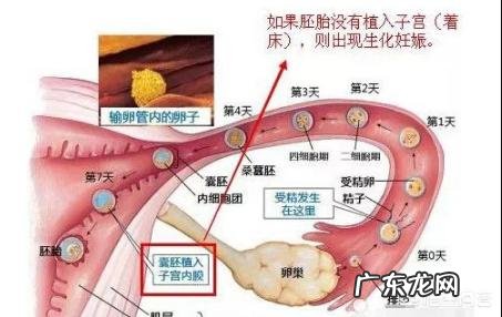 受精卵为什么会着床失败?