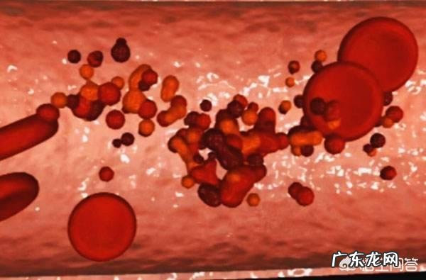 什么血型的爸妈组合生的孩子容易溶血?