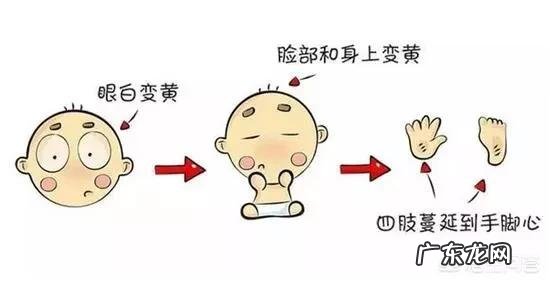 怎样知道孩子的黄疸还有没有？