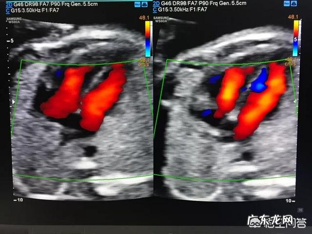 四维彩超几个月才能做?