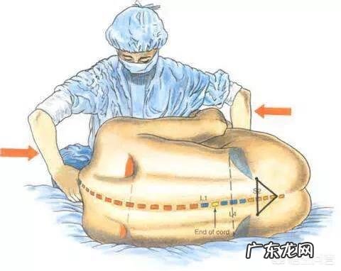 无痛分娩是在彻底的“消灭”产痛吗?