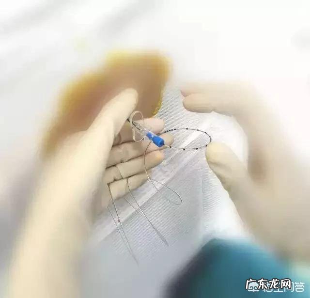 无痛分娩是在彻底的“消灭”产痛吗?