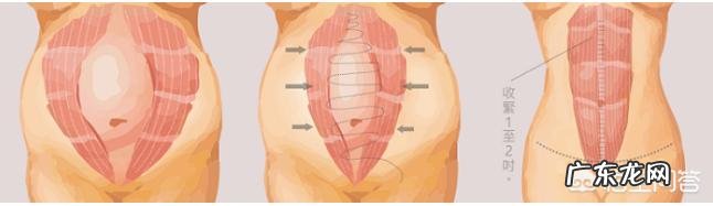 产后肚皮松弛怎么恢复?
