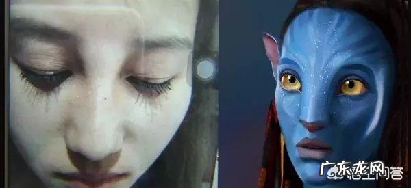 玻尿酸打多了会有副作用产生吗?