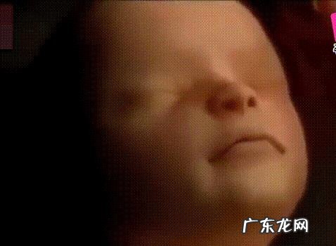 怀孕四个多月,胎儿头位是什么姿势照片?