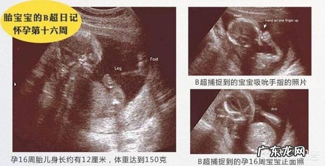 怀孕四个多月，胎儿头位是什么姿势照片？