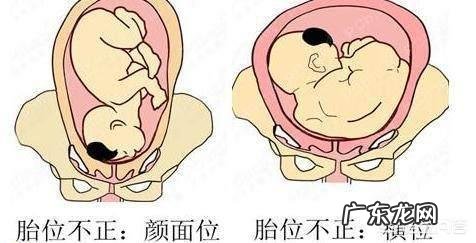 孕晚期胎儿入盆会有什么症状提示?都要注意什么事项呢?