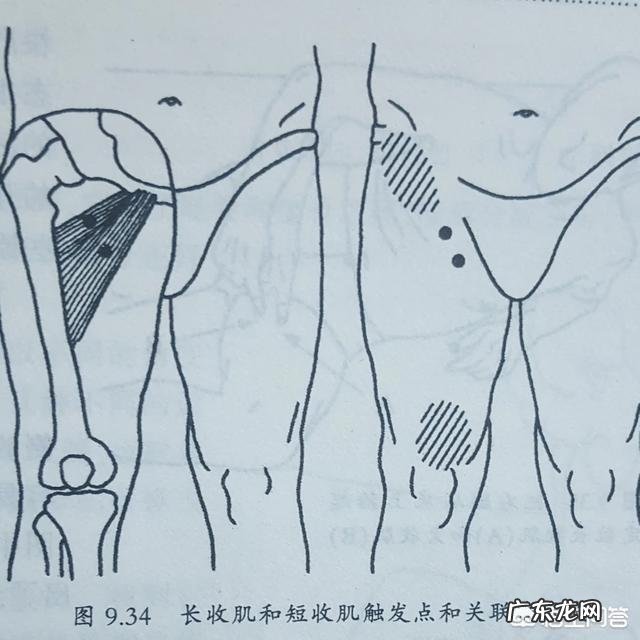 五十四岁腰肌劳损怎么办?