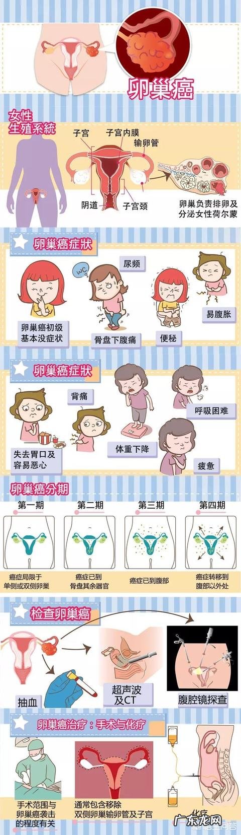 卵巢肿瘤的早期症状如何预防卵巢肿瘤?