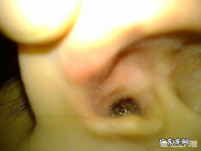 耳朵进水了出不来怎么办?