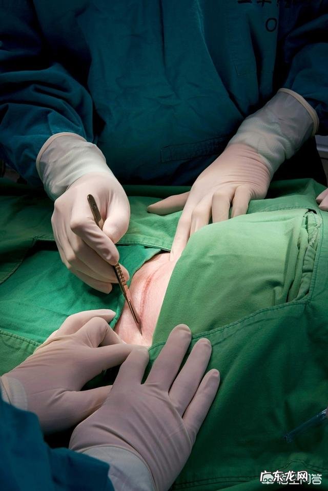 产后的剖腹产刀口该如何护理?