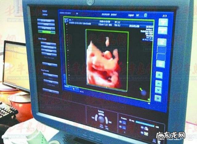 怀孕以后多久去医院检查一次比较合适?