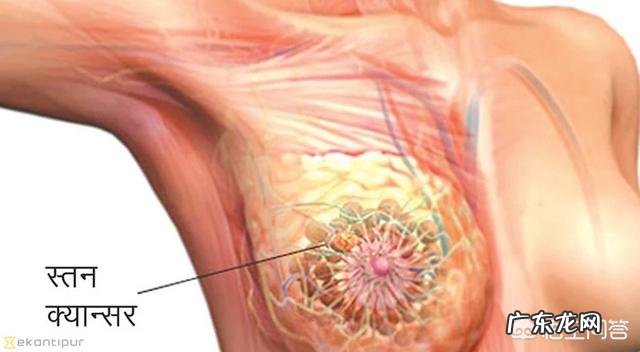 胸部乳房疼痛是什么原因?